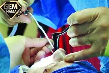 مرگ به خاطر زیبایی شارلاتان هایی که دست به تیغ می شوند