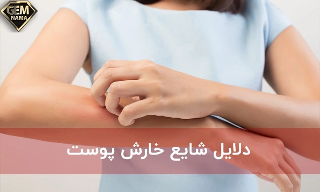 خارش بدن نشانه چیست