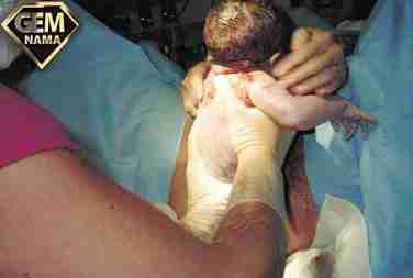 آشنایی با روش های زایمان