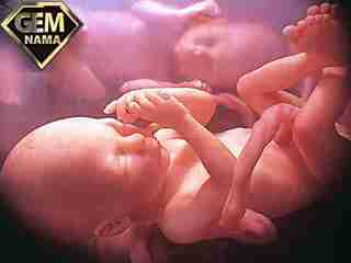 تعیین جنسیت بچه بدون سونوگرافی