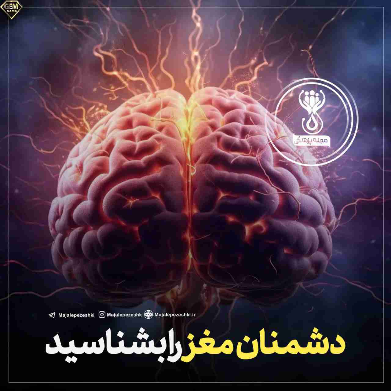 دشمنان مغز را بشناسید