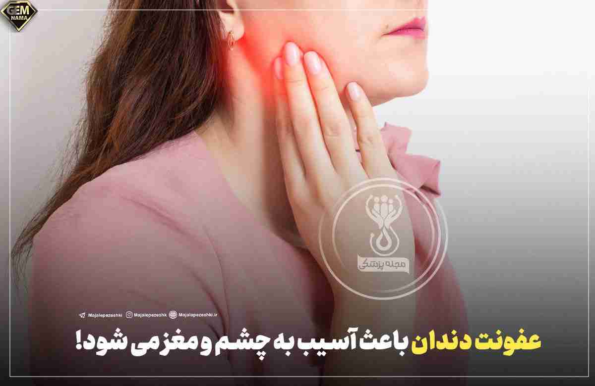عفونت دندان باعث آسیب به چشم و مغز می شود