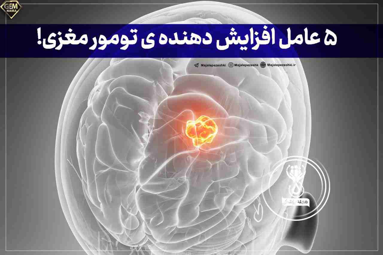 5 عامل افزایش دهنده ی تومور مغزی
