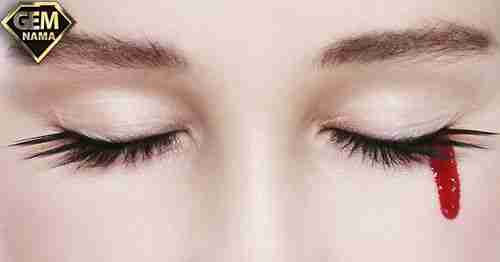 اصطلاح خون گریه کردن واقعیست