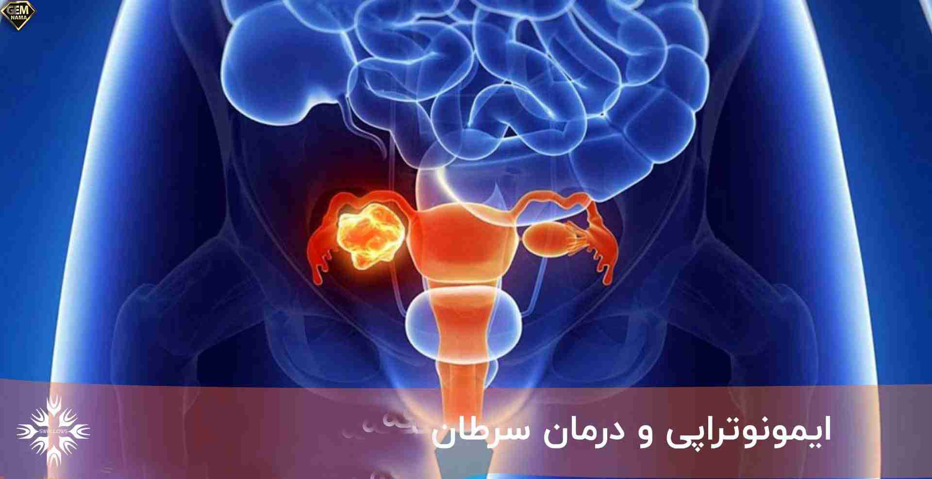 انقلاب در درمان سرطان ایمونوتراپی امید جدید برای بیماران