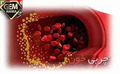 چربی خون در بدن چه علائمی دارد