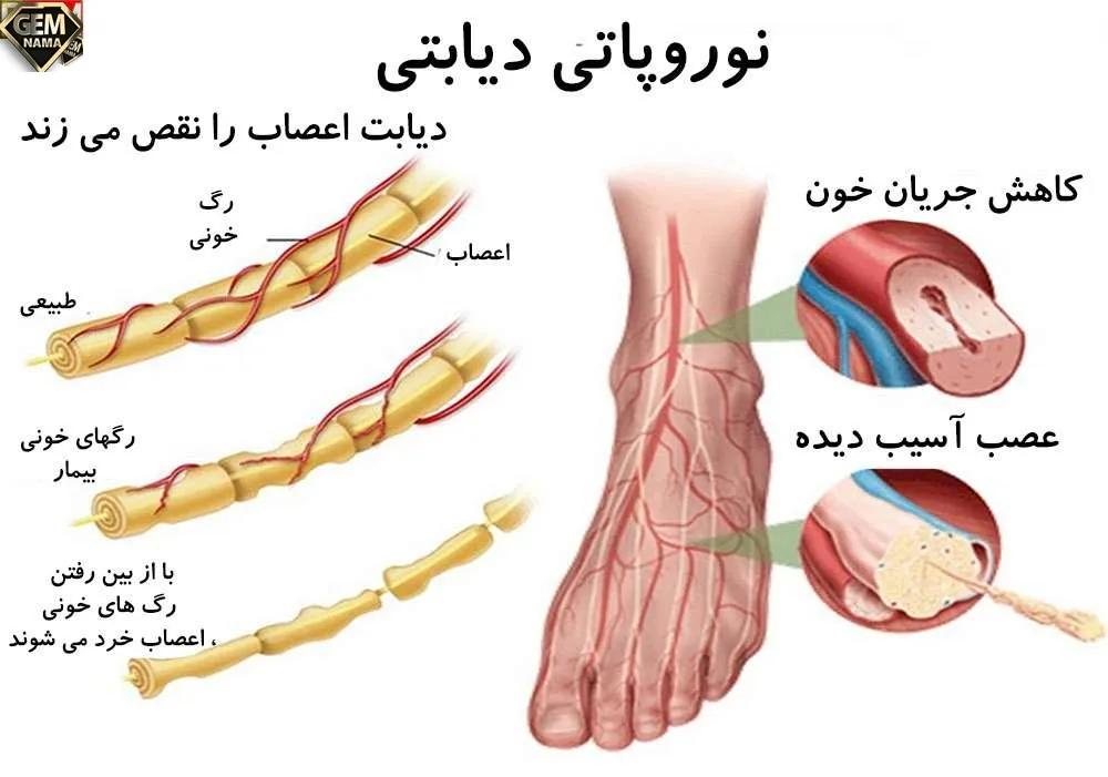منشا درد محیطی